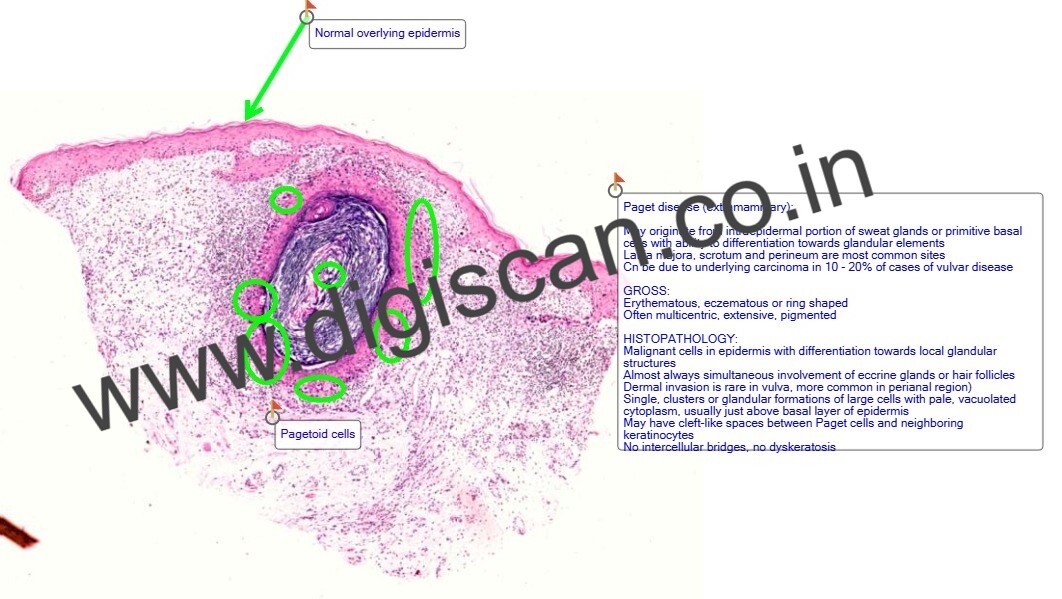 Dermatopathology Quiz Cases (Digital Slides for PG Exam & Self-Assessment)